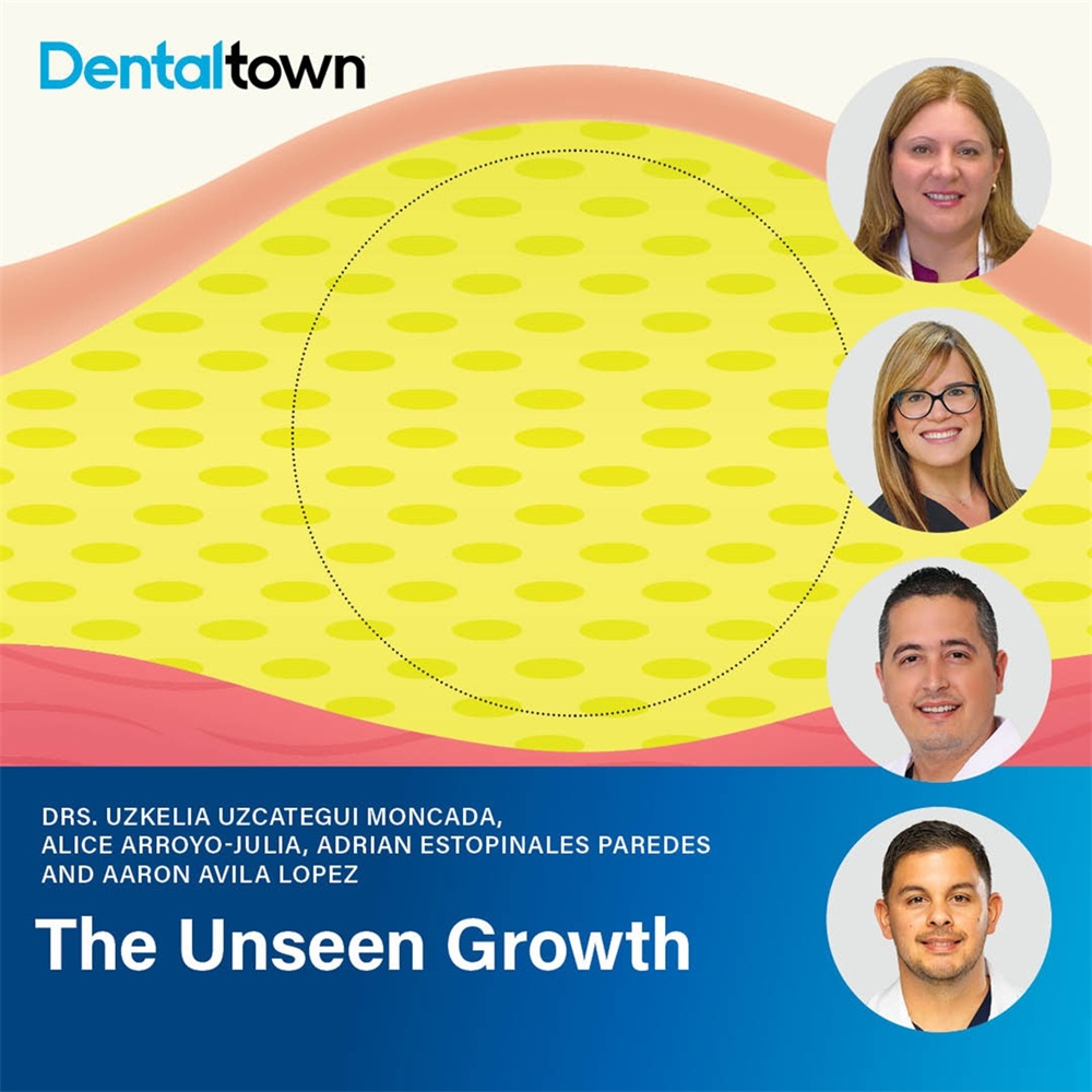 The Unseen Growth